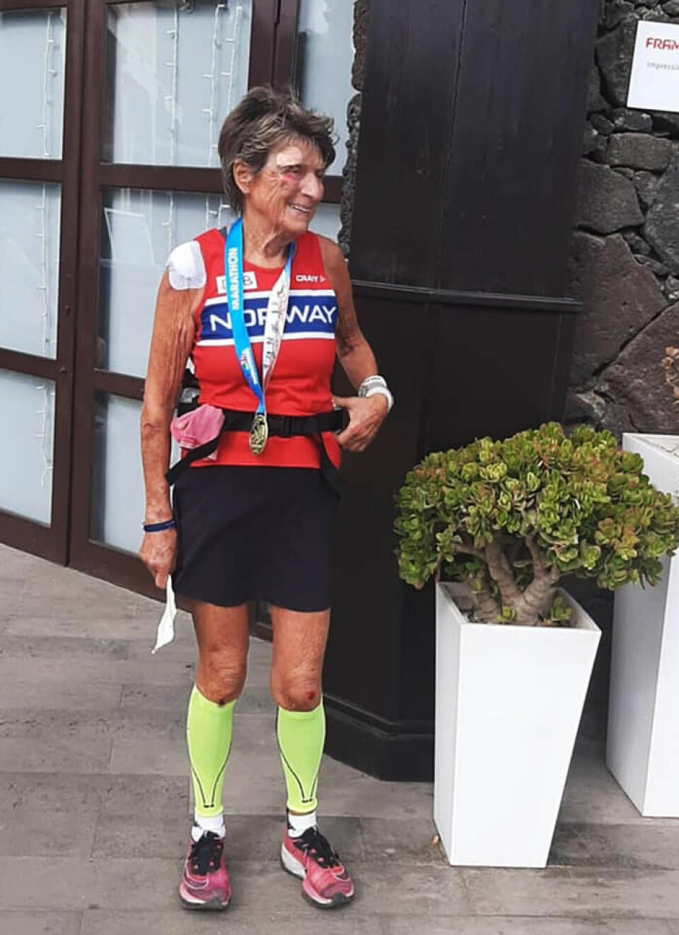 Vera Nystad plastret og sammensydd etter fall på Lanzarote Marathon. (Foto: privat)