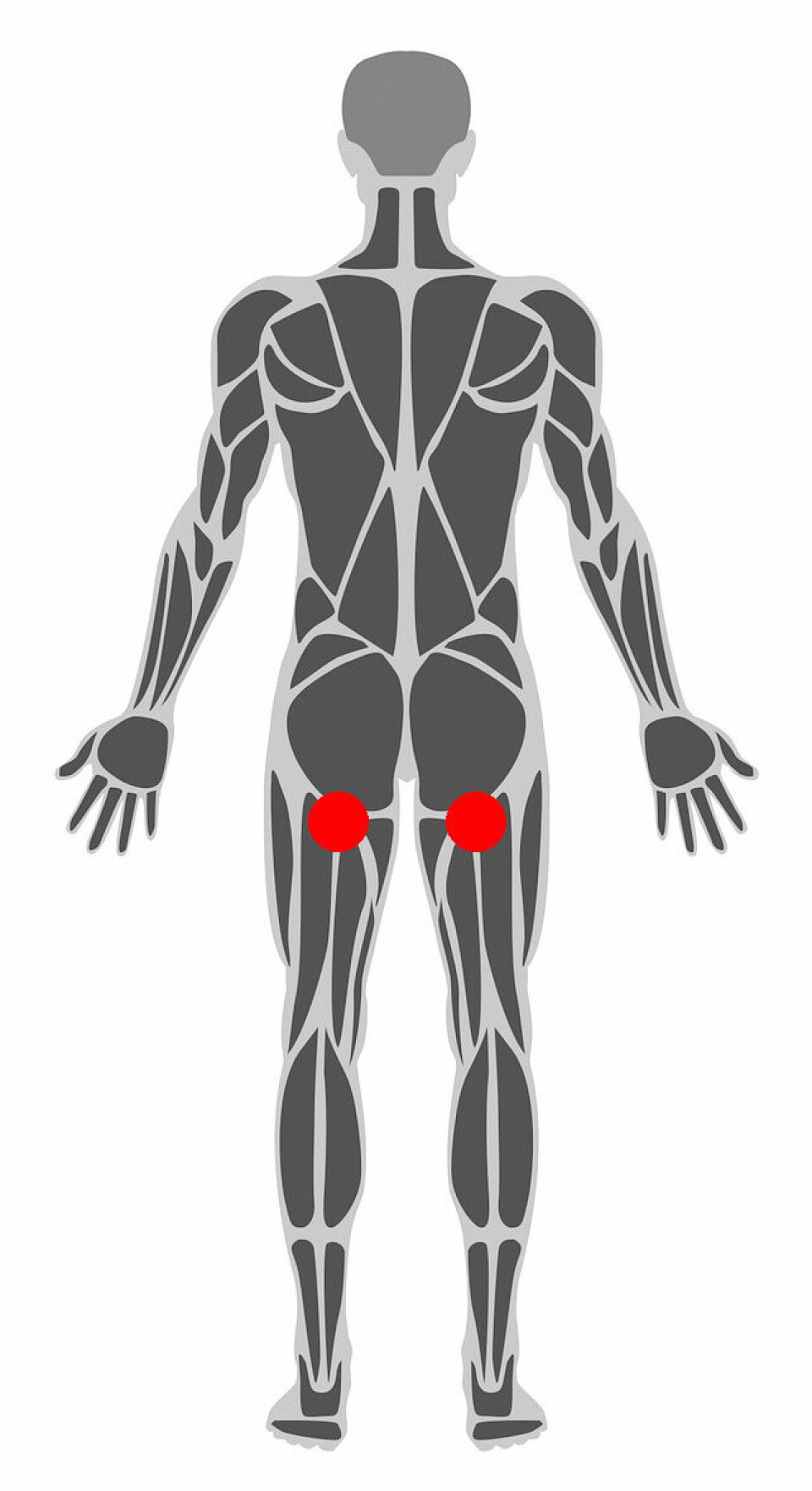 Løsningen på en skade mange løpere sliter med hamstring-pain.jpg