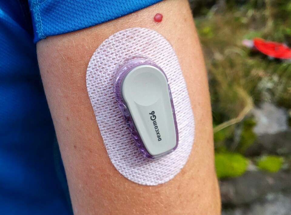 Marianne R. Årdalen løper 80 kilometer i uka med diabetes Marianne R. Årdalen løper ultra med diabetes