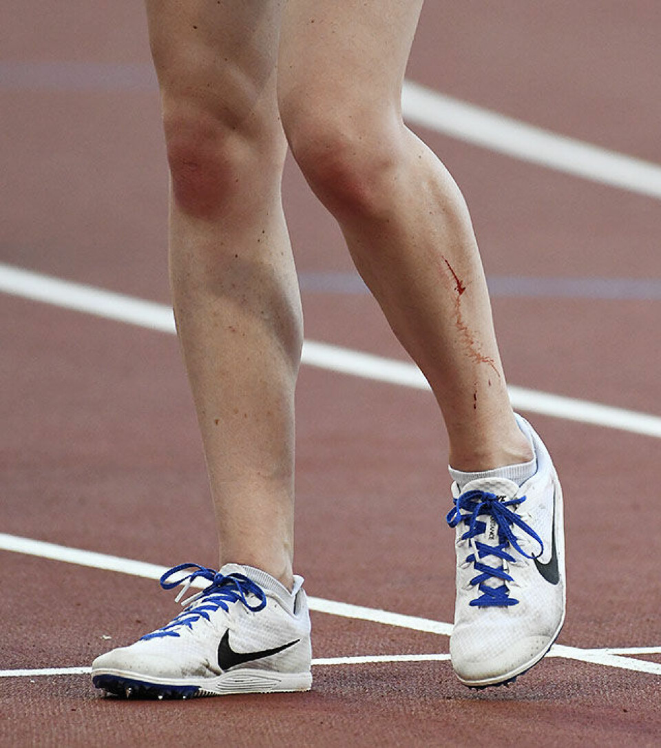 Karoline Bjerkeli Grøvdal finaleklar på 5000 m 5000-1-legg-blod_50D8493.jpg