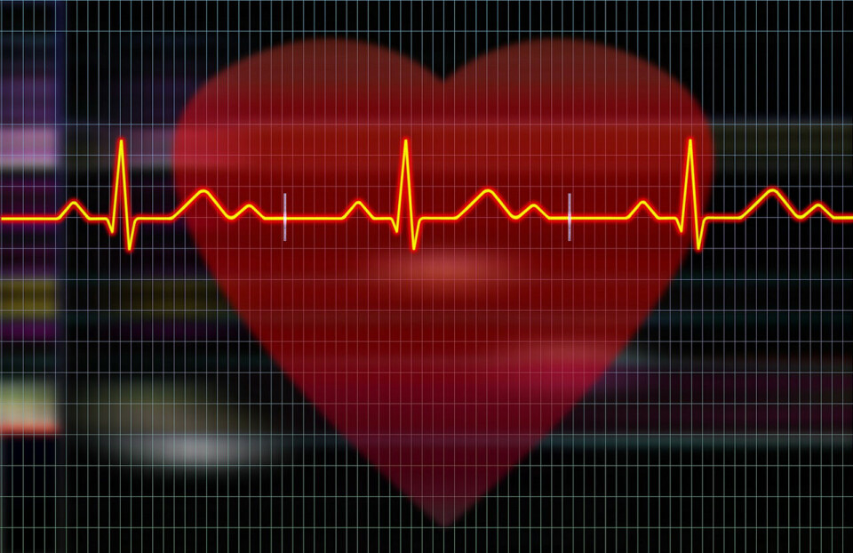 I den nye undersøkelsen vil forskerne prøve å finne ut hva slags trening som fungerer best hvis en sliter med atrieflimmer. (Foto: Pixabay) I den nye undersøkelsen vil forskerne prøve å finne ut hva slags trening som fungerer best hvis en sliter med atrieflimmer. (Foto: Pixabay)