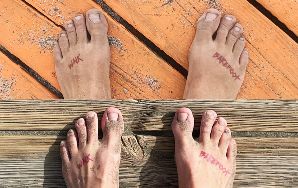 Før og etter: Det øverste bildet er tatt før Christina begynte å trene stortåa som følge av en plantar fascitt-skade i 2020. Det nederste bildet viser foten av i dag – etter opptreningen. (Foto: Christina Forstrønen Bruarøy) Før og etter: Det øverste bildet er tatt før Christina begynte å trene stortåa som følge av en plantar fascitt-skade i 2020. Det nederste bildet viser foten av i dag – etter opptreningen. (Foto: Christina Forstrønen Bruarøy)